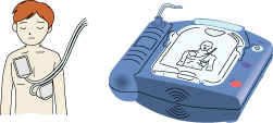 AEDの使い方 その２「パッドを貼る」